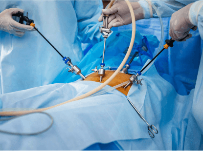 أورام الغدة النكافية